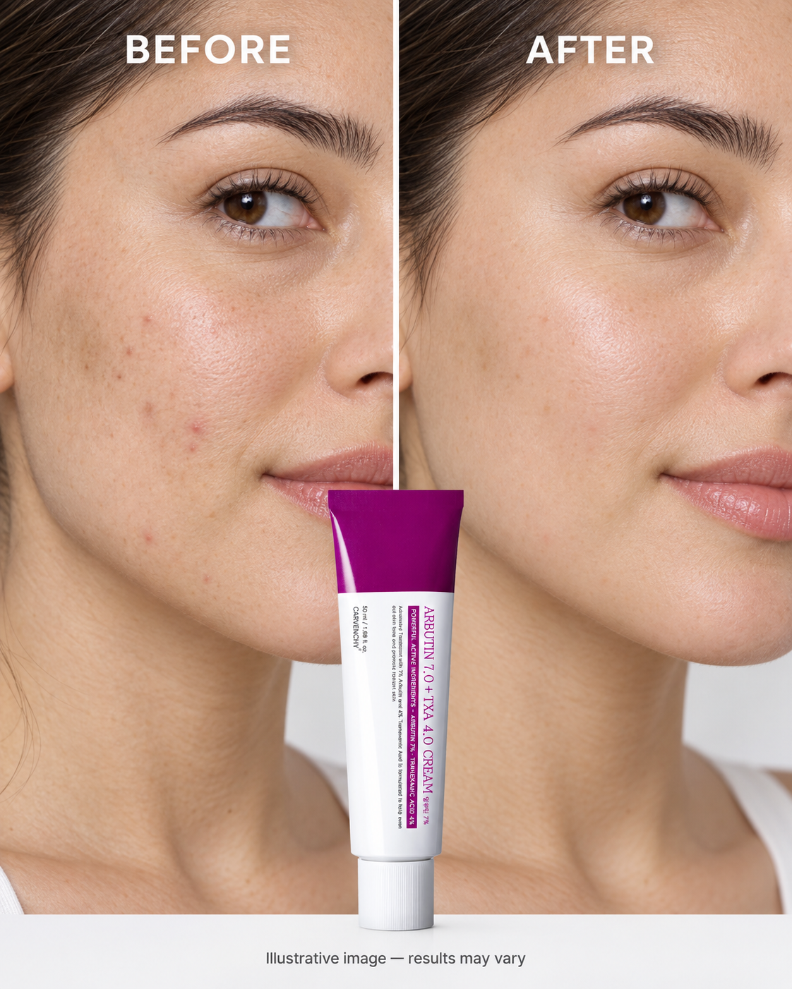 Ivory  Arbutin 7% + Tranexamic Acid 4% Cream