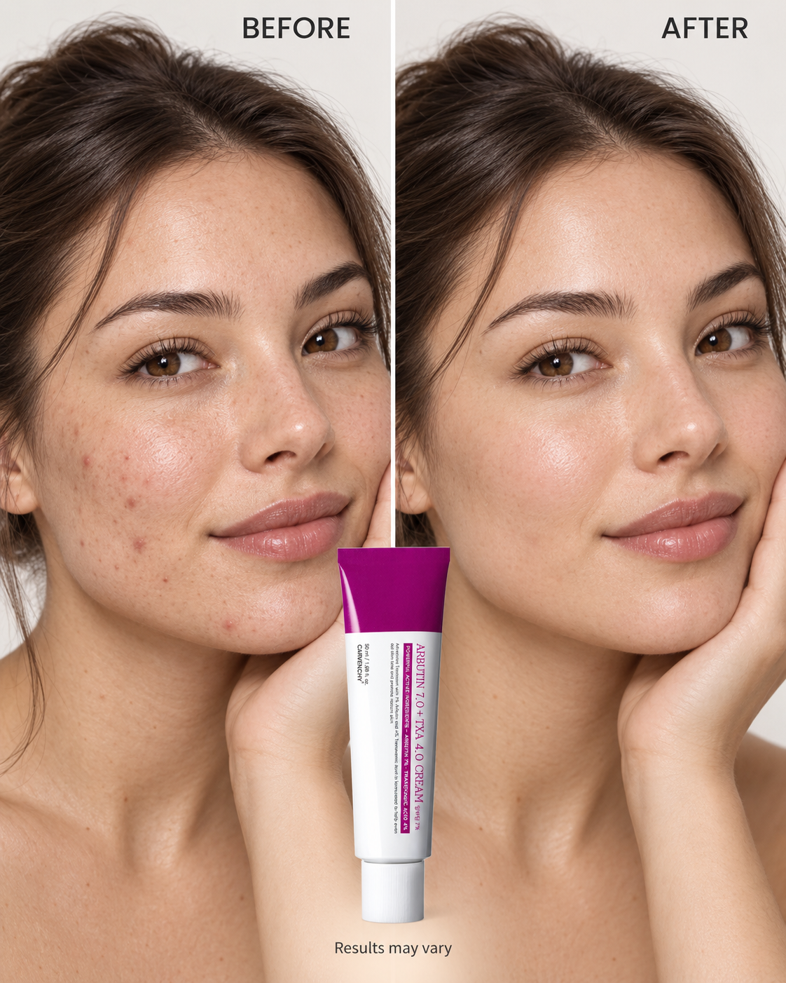 Ivory  Arbutin 7% + Tranexamic Acid 4% Cream